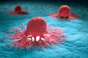 Immunothérapie et chimio-embolisation dans le CHC