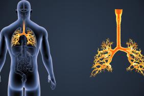 Cryothérapie et immunothérapie dans le cancer bronchique