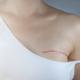 La mastectomie bilatérale