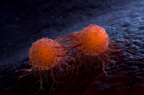Cancers du sein RH+ HER2- en récidive agressive